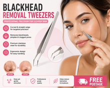 Load image into Gallery viewer, Blackhead Removal Tweezers - Straight – Professional Precision for Clearer Skin &amp; FREE POSTAGE