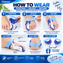 Load image into Gallery viewer, Glamza Bunion Splint Corrector Device Pair – Adjustable Big Toe Alignment Support