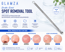 Load image into Gallery viewer, Glamza Double Ended Spot Removal Tool – Precision Blackhead &amp; Pimple Extractor