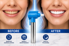 Load image into Gallery viewer, Luma Smile Teeth Polishing Gun - Free UK Delivery
