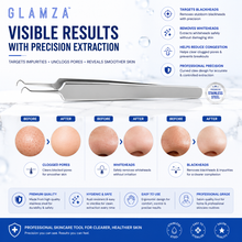 Load image into Gallery viewer, Glamza Curved Blackhead Removal Claw Tweezer