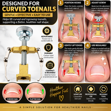 Load image into Gallery viewer, Ingrown Toenail Corrector Clamp – Professional Nail Correction Tool