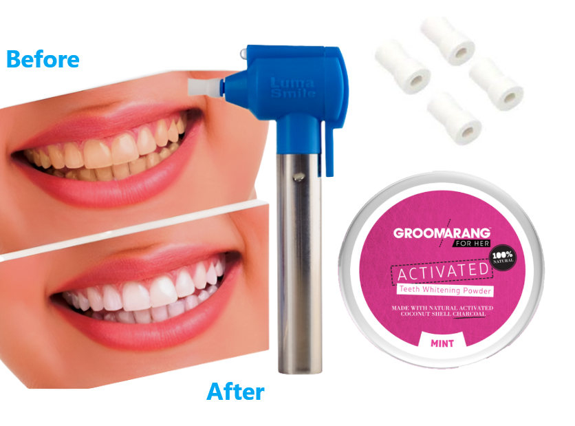 Charcoal Powder & Luma Smile Polishing Gun - Free UK Delivery