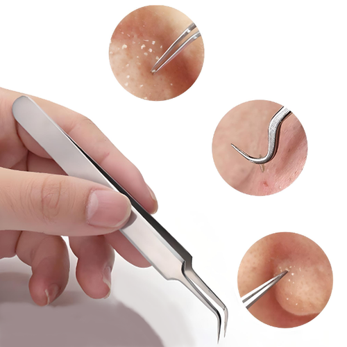 Blackhead Removal Tweezer Set – Straight & Curved Precision Tweezers for Clearer Skin | FREE POSTAGE
