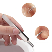 Load image into Gallery viewer, Blackhead Removal Tweezers - Straight – Professional Precision for Clearer Skin &amp; FREE POSTAGE