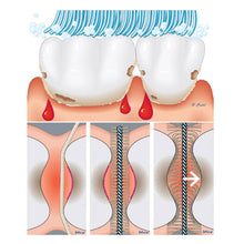 Load image into Gallery viewer, Glamza Interdental Brushes