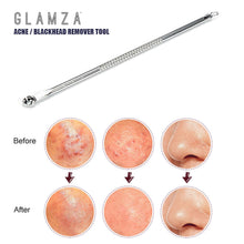 Load image into Gallery viewer, Glamza Double Ended Spot Removal Tool