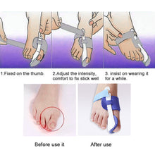Load image into Gallery viewer, Glamza Splint Corrector Device Pair