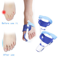 Load image into Gallery viewer, Glamza Splint Corrector Device Pair