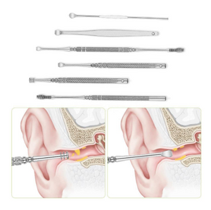 Glamza 6pc Ear Wax Removal Kit